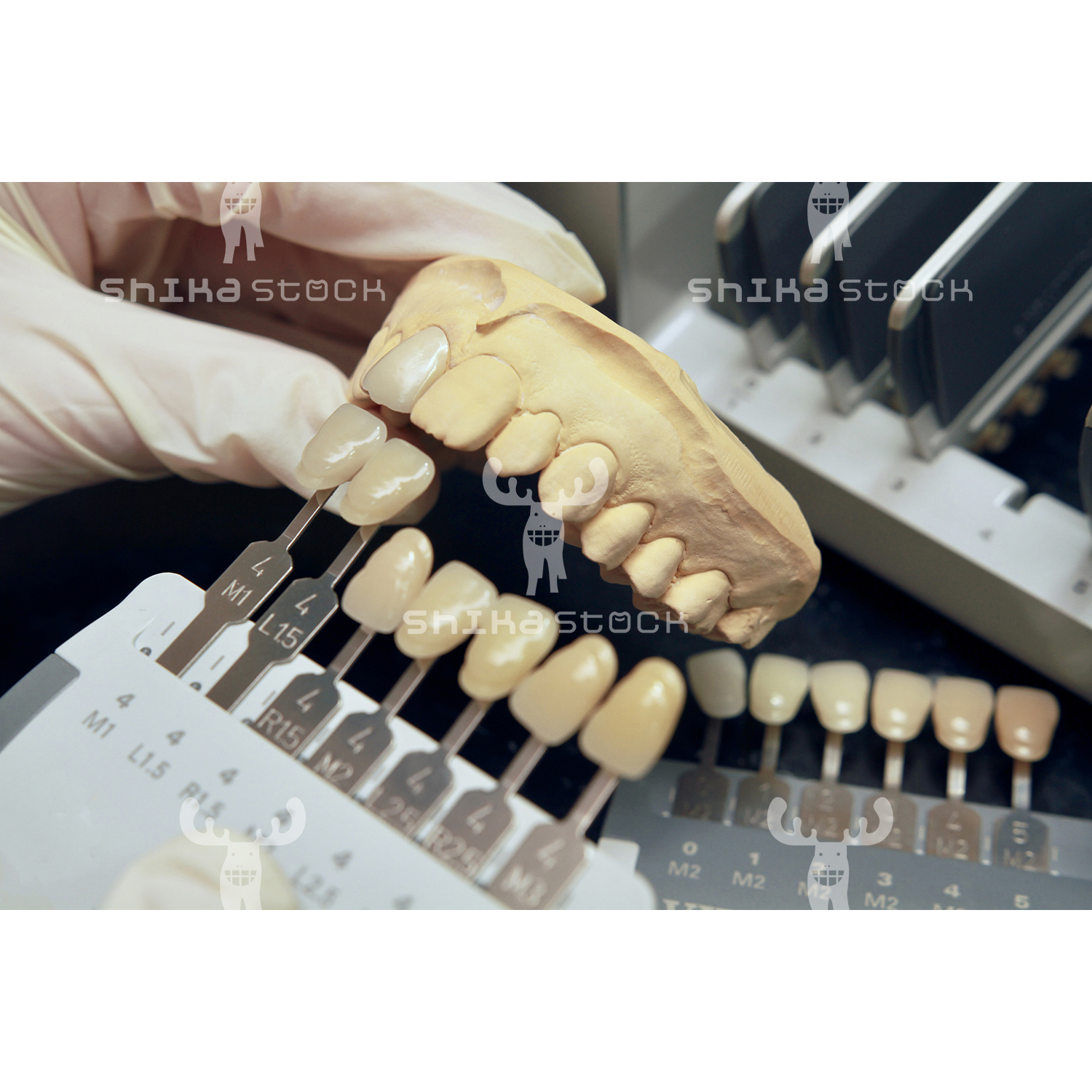【Mサイズ】歯科技工物の色合わせ