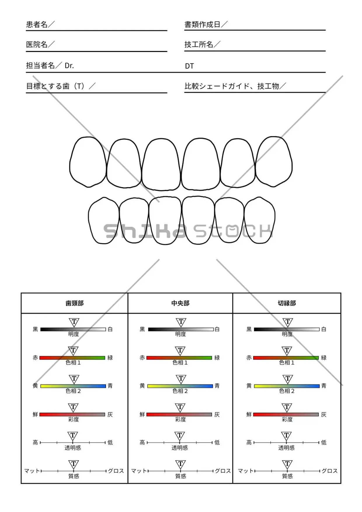 シェードテイキング記録シート（印刷用２点セット）